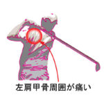 ゴルフ初心者必見！ストレッチで才能が開花する方法